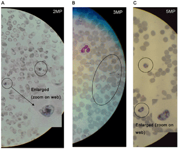 Imágenes de parásitos de la malaria tomadas con cámaras de teléfonos móviles con diferentes resoluciones (Foto cortesía de la revista PLoS ONE).